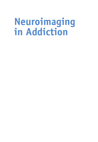 Neuroimaging in Addiction