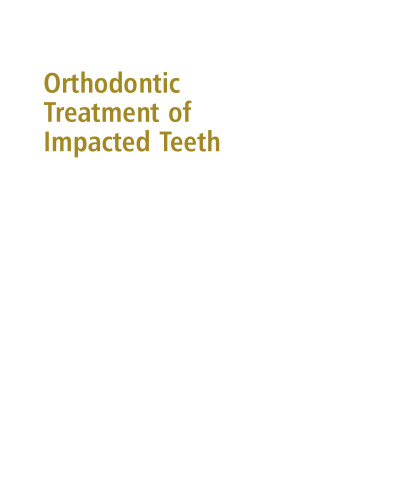 Orthodontic Treatment of Impacted Teeth