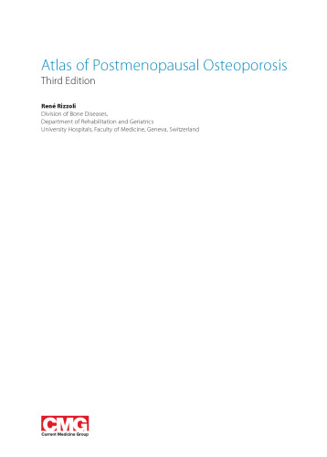 Atlas of Postmenopausal Osteoporosis