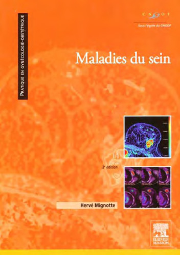 Maladies du sein