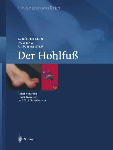 Fussdeformitäten: Der Hohlfuss