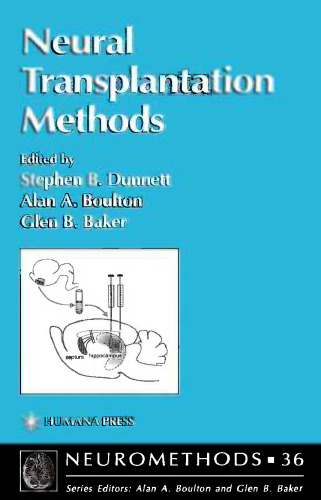 Neural Transplantation Methods