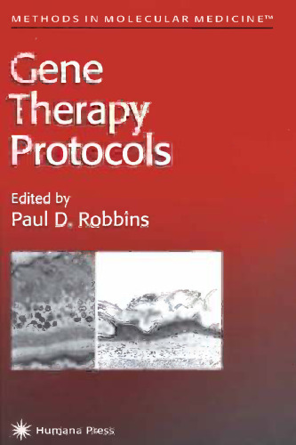 Gene Therapy Protocols