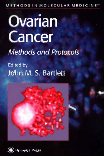 Ovarian Cancer: Methods and Protocols