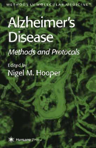 Alzheimer's Disease: Methods and Protocols