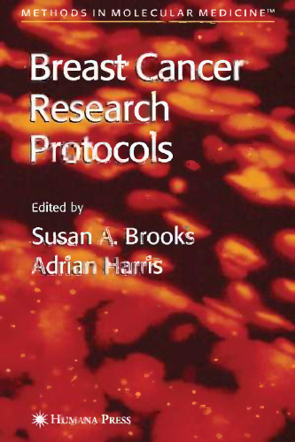 Breast Cancer Research Protocols