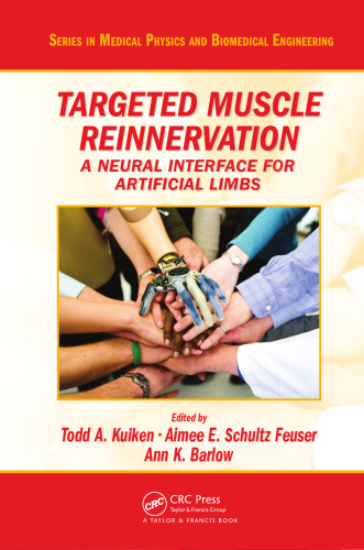 Targeted Muscle Reinnervation: A Neural Interface for Artificial Limbs