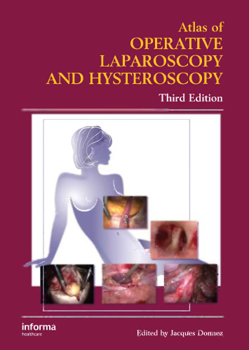 Atlas of operative laparoscopy and hysteroscopy