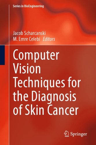 Computer Vision Techniques for the Diagnosis of Skin Cancer