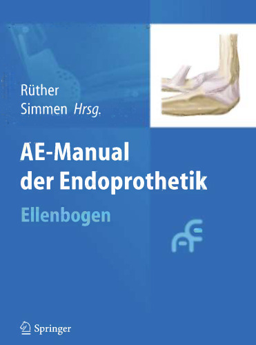 AE-Manual der Endoprothetik: Ellenbogen