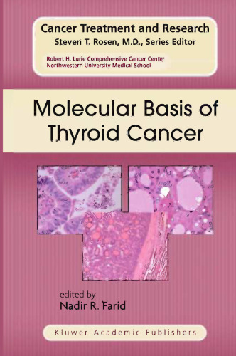 Molecular Basis of Thyroid Cancer