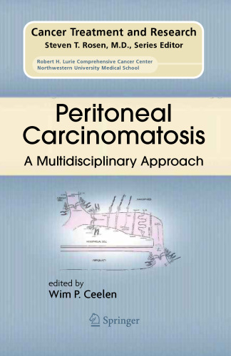 Peritoneal Carcinomatosis: A Multidisciplinary Approach