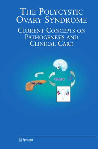 The Polycystic Ovary Syndrome: Current Concepts On Pathogenesis And Clinical Care