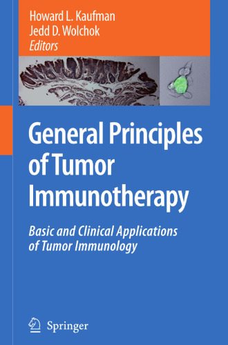 General Principles of Tumor Immunotherapy: Basic and Clinical Applications of Tumor Immunology