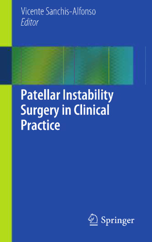 Patellar Instability Surgery in Clinical Practice