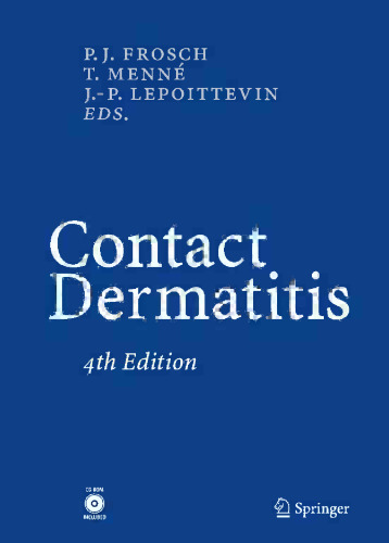 Contact Dermatitis