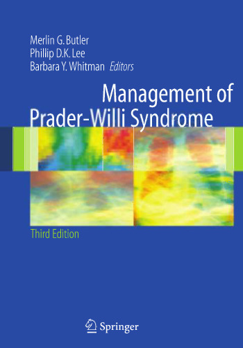 Management of Prader-Willi Syndrome