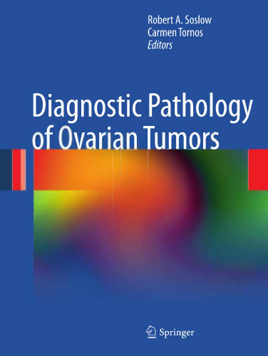 Diagnostic Pathology of Ovarian Tumors