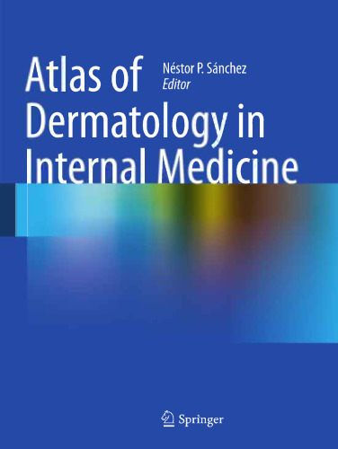 Atlas of Dermatology in Internal Medicine