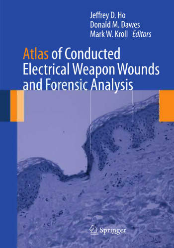 Atlas of Conducted Electrical Weapon Wounds and Forensic Analysis