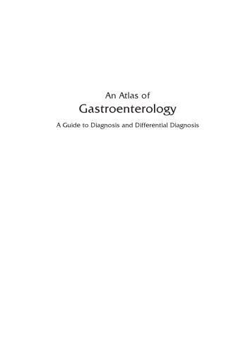 An Atlas of Gastroenterology: A Guide to Diagnosis and Differential Diagnosis