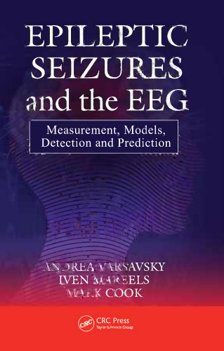 Epileptic seizures and the EEG : measurement, models, detection and prediction