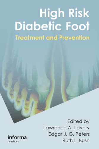 High risk diabetic foot : treatment and prevention