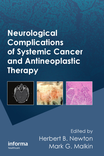 Neurological complications of systemic cancer and antineoplastic therapy