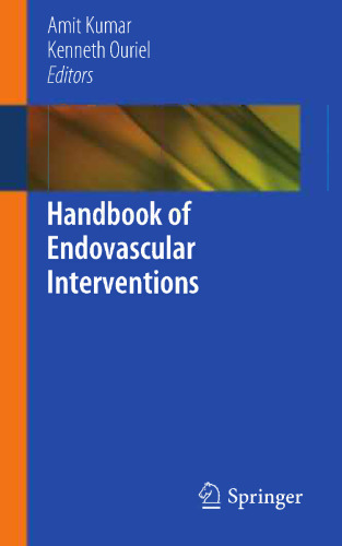 Handbook of Endovascular Interventions