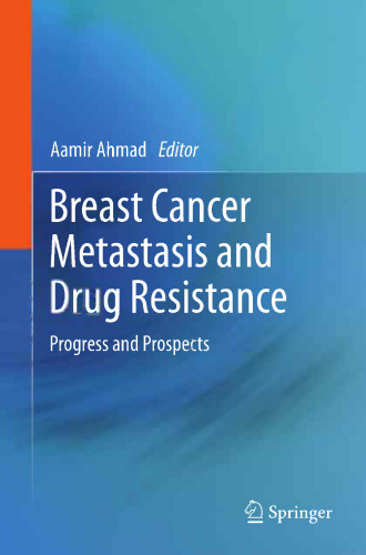 Breast Cancer Metastasis and Drug Resistance: Progress and Prospects