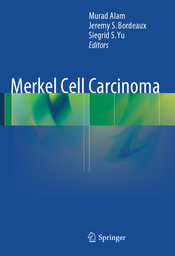 Merkel Cell Carcinoma