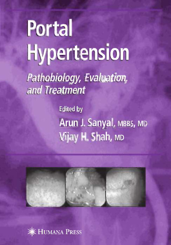 Portal Hypertension: Pathobiology, Evaluation, and Treatment