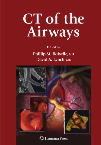 CT of the Airways