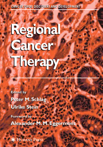 Regional Cancer Therapy