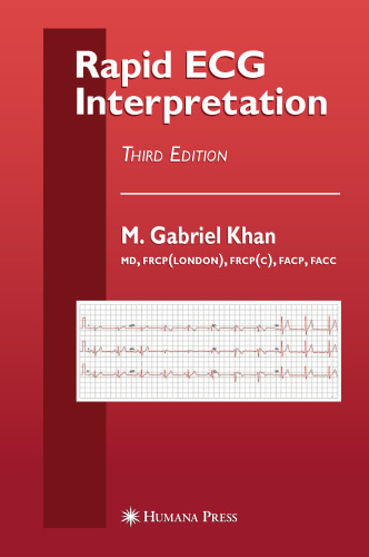 Rapid ECG Interpretation