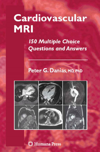 Cardiovascular MRI: 150 Multiple Choice Questions and Answers