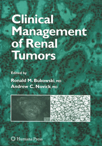 Clinical Management of Renal Tumors