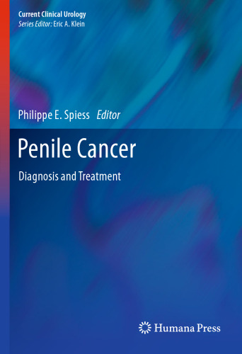 Penile Cancer: Diagnosis and Treatment