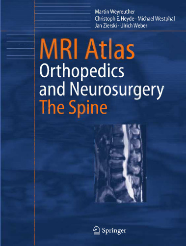 MRI Atlas Orthopedics and Neurosurgery The Spine