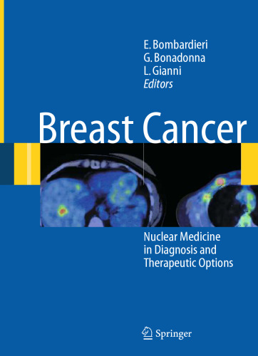 Breast Cancer: Nuclear Medicine in Diagnosis and Therapeutic Options