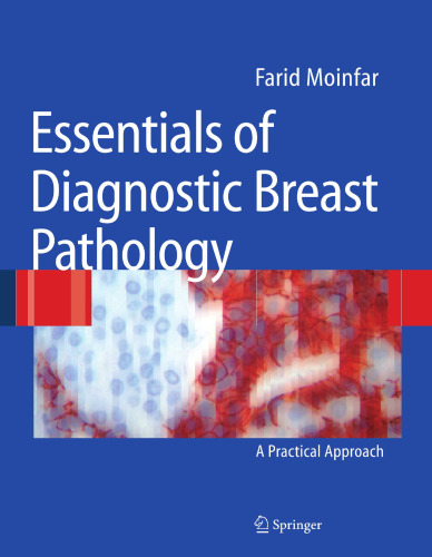 Essentials of Diagnostic Breast Pathology: A Practical Approach