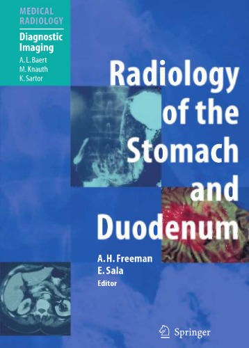 Radiology of the Stomach and Duodenum