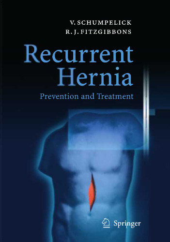 Recurrent Hernia: Prevention and Treatment