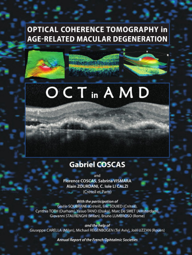 Optical Coherence Tomography in Age-Related Macular Degeneration: OCT in AMD