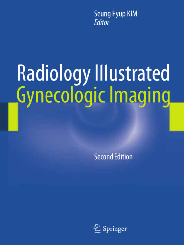 Radiology Illustrated: Gynecologic Imaging