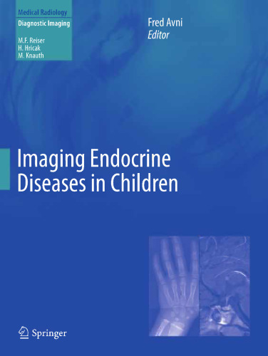 Imaging Endocrine Diseases in Children