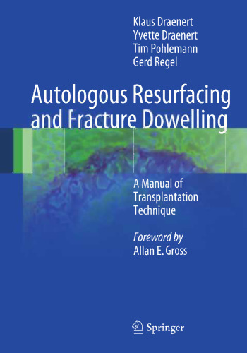 Autologous Resurfacing and Fracture Dowelling: A Manual of Transplantation Technique