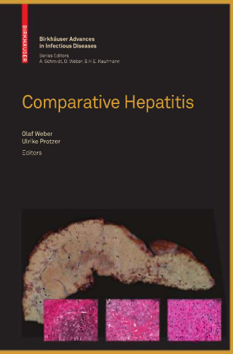 Comparative Hepatitis