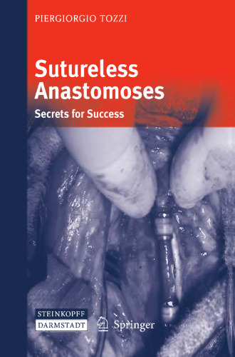 Sutureless Anastomoses: Secrets for Success