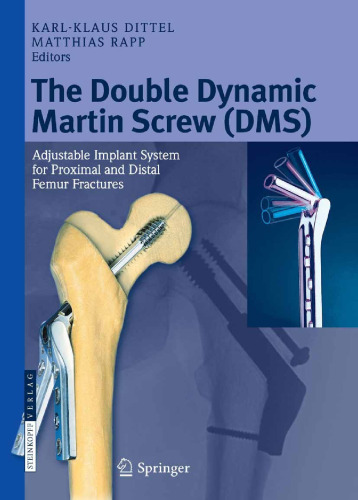 The Double Dynamic Martin Screw (DMS): Adjustable Implant System for Proximal and Distal Femur Fractures